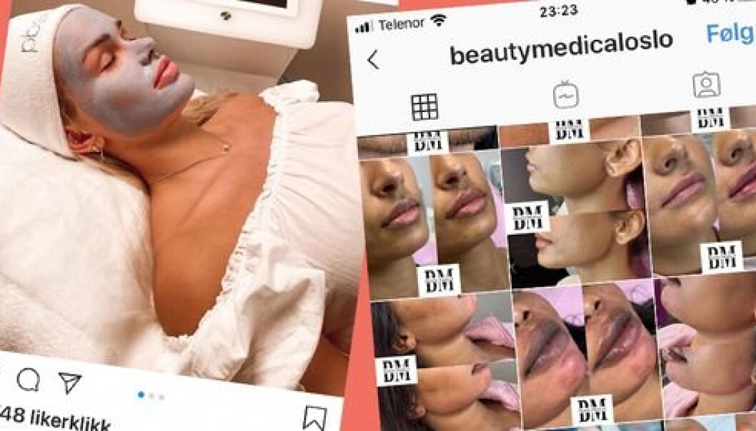Influencermarkedsføring fra Ida Johansen Aaserud for Beauty Medical Oslo er i strid med Fims retningslinjer. Influencermarkedsføring fra Ida Johansen Aaserud for Beauty Medical Oslo er i strid med Fims retningslinjer.