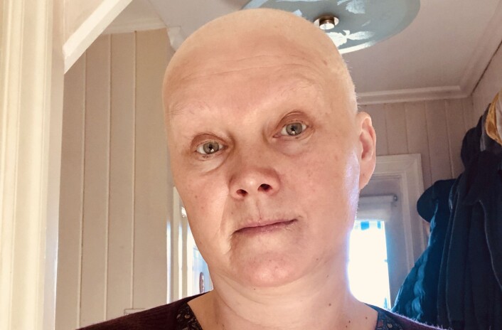 CELLEGIFT: Eli Strand har vært i gjennom sterke behandlinger, noe hun kjenner både psykisk og fysisk. Hun opplevde også å miste håret. CELLEGIFT: Eli Strand har vært i gjennom sterke behandlinger, noe hun kjenner både psykisk og fysisk. Hun opplevde også å miste håret.